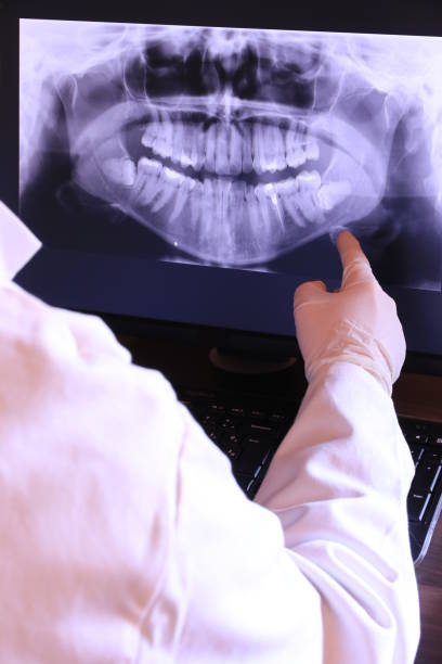 Best Chipped Tooth Repair Near Me  in Marionville, MO